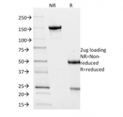 SDS-PAGE analysis of purified, BSA-free Villin antibody (clone VIL1/2376) as confirmation of integrity and purity.