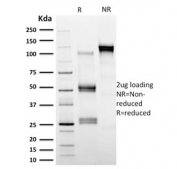 SDS-PAGE analysis of purified, BSA-free Calpastatin antibody (clone CAST/1550) as confirmation of integrity and purity.