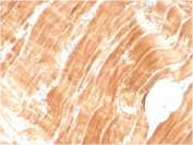 IHC staining of FFPE human skeletal muscle tissue with Actinin Alpha 2 antibody (clone ACTN2/3294). HIER: boil tissue sections in pH 9 10mM Tris with 1mM EDTA for 10-20 min and allow to cool before testing.