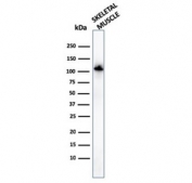 Western blot testing of human skeletal muscle lysate with Actinin Alpha 2 antibody. Predicted molecular weigth ~103 kDa.