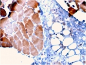 IHC staining of FFPE human skeletal muscle tissue with Actinin Alpha 2 antibody (clone ACTN2/3295). HIER: boil tissue sections in pH 9 10mM Tris with 1mM EDTA for 10-20 min and allow to cool before testing.
