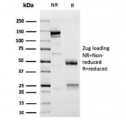 SDS-PAGE analysis of purified, BSA-free Actinin Alpha 2 antibody as confirmation of integrity and purity.