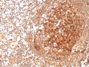 IHC staining of FFPE human tonsil with GCLM antibody (clone CPTC-GCLM-1). HIER: boil tissue sections in pH 9 10mM Tris with 1mM EDTA for 20 min and allow to cool before testing.