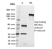 SDS-PAGE analysis of purified, BSA-free CD22 antibody (clone RFB4) as confirmation of integrity and purity.