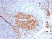 IHC staining of FFPE human tonsil with CD27 antibody (clone LPFS2/1611). HIER: boil tissue sections in pH 9 10mM Tris with 1mM EDTA for 20 min and allow to cool before testing.