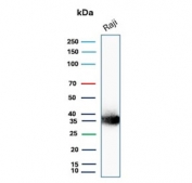 Western blot testing of human Raji cell lysate with recombinant CD74 antibody (clone CLIP/3127R). Expected molecular weight: 33-43 kDa.