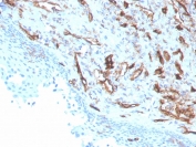 IHC staining of FFPE human tonsil with CD31 antibody (clone PECAM1/3529). HIER: boil tissue sections in pH 9 10mM Tris with 1mM EDTA for 10-20 min and allow to cool before testing.