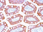 IHC staining of FFPE human colon with recombinant CK20 antibody (clone KRT20/3129R). HIER: boil tissue sections in pH 9 10mM Tris with 1mM EDTA for 20 min and allow to cool before testing.
