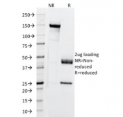 SDS-PAGE analysis of purified, BSA-free Cytokeratin 5/6/18 antibody (clone SPM267) as confirmation of integrity and purity.