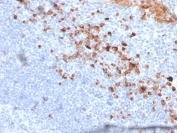 IHC staining of FFPE human tonsil with CD5L antibody (clone CD5L/2991). HIER: boil tissue sections in pH 9 10mM Tris with 1mM EDTA for 20 min and allow to cool before testing.