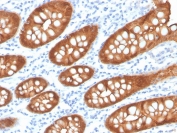 IHC staining of FFPE human colon with recombinant Villin antibody (clone VIL1/4107R). HIER: boil tissue sections in pH 9 10mM Tris with 1mM EDTA for 20 min and allow to cool before testing.