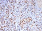 IHC staining of FFPE human tonsil with CD63 antibody (clone LAMP3/3315). HIER: boil tissue sections in pH 9 10mM Tris with 1mM EDTA for 20 min and allow to cool before testing.