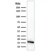 Western blot testing of human PANC-1 cell lysate with CELA3B antibody (clone CELA3B/1374).