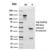 SDS-PAGE analysis of purified, BSA-free recombinant ITGAE antibody (clone rITGAE/2063) as confirmation of integrity and purity.