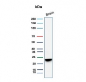 Western blot testing of human brain tissue with recombinant Myelin Basic Protein antibody. Expected molecular weight: 22-37 kDa.
