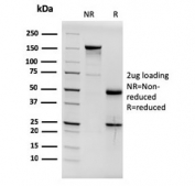 SDS-PAGE analysis of purified, BSA-free Estrogen Receptor alpha antibody (clone ESR1/3564) as confirmation of integrity and purity.