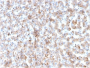 IHC staining of FFPE human liver with APOB antibody. HIER: boil tissue sections in pH 9 10mM Tris with 1mM EDTA for 20 min and allow to cool before testing.