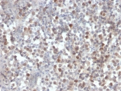 IHC staining of FFPE human kidney with RAD51 antibody. HIER: boil tissue sections in pH 9 10mM Tris with 1mM EDTA for 20 min and allow to cool before testing.