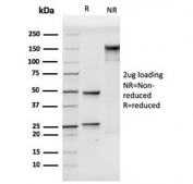 SDS-PAGE analysis of purified, BSA-free CD106 antibody (clone VCAM1/3499) as confirmation of integrity and purity.