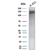 Western blot testing of human A431 cell lysate with EGFR antibody. Expected molecular weight: 134-180 kDa depending on glycosylation level.