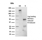 SDS-PAGE analysis of purified, BSA-free PSMD4 antibody as confirmation of integrity and purity.