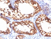 IHC staining of FFPE human testis with Vinculin antibody (clone VCL/3617). HIER: boil tissue sections in pH 9 10mM Tris with 1mM EDTA for 20 min and allow to cool before testing.