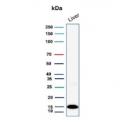 Western blot testing of human liver lysate with Transthyretin antibody (clone TTR/4292). Predicted molecular weight ~16 kDa.