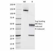 SDS-PAGE analysis of purified, BSA-free Cytokeratin 5/6 antibody (clone KRT5.6/2090) as confirmation of integrity and purity.