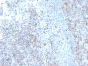 IHC staining of FFPE human tonsil with recombinant CD50 antibody (clone rICAM3/1019). HIER: boil tissue sections in pH 9 10mM Tris with 1mM EDTA for 20 min and allow to cool before testing.
