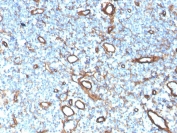 IHC staining of FFPE human tonsil with recombinant Collagen IV antibody. HIER: boil tissue sections in pH 9 10mM Tris with 1mM EDTA for 20 min and allow to cool before testing.