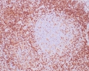 IHC staining of FFPE human tonsil tissue with recombinant CD4 antibody. HIER: boil tissue sections in pH 9 10mM Tris with 1mM EDTA for 20 min and allow to cool before testing.