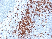 IHC staining of FFPE human tonsil tissue with recombinant CD8A antibody (clone CD8/4391R). HIER: boil tissue sections in pH 9 10mM Tris with 1mM EDTA for 20 min and allow to cool before testing.