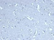Negative control: IHC staining of FFPE human brain tissue with recombinant CD8A antibody (clone CD8/4391R). HIER: boil tissue sections in pH 9 10mM Tris with 1mM EDTA for 20 min and allow to cool before testing.