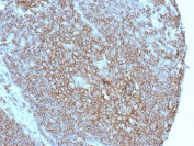 IHC staining of FFPE human tonsil tissue with CD86 antibody (clone C86/3716). HIER: boil tissue sections in pH 9 10mM Tris with 1mM EDTA for 20 min and allow to cool before testing.