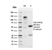 SDS-PAGE analysis of purified, BSA-free recombinant Ferritin Light Chain antibody as confirmation of integrity and purity.