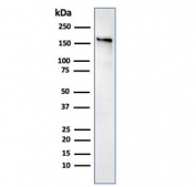 Western blot testing of human kidney lysate with ACE antibody. Expected molecular weight 140-170+ kDa depending on glycosylation level.