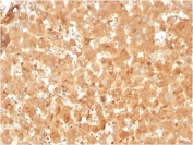 IHC staining of FFPE human liver with A2M antibody. HIER: boil tissue sections in pH 9 10mM Tris with 1mM EDTA for 20 min and allow to cool before testing.