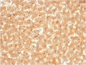 IHC staining of FFPE human liver with A2M antibody. HIER: boil tissue sections in pH 9 10mM Tris with 1mM EDTA for 20 min and allow to cool before testing.