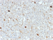IHC staining of FFPE human liver with APOAIV antibody. HIER: boil tissue sections in pH 9 10mM Tris with 1mM EDTA for 20 min and allow to cool before testing.