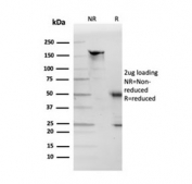 SDS-PAGE analysis of purified, BSA-free Apolipoprotein D antibody as confirmation of integrity and purity.