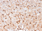 IHC staining of FFPE human liver with APOD antibody. HIER: boil tissue sections in pH 9 10mM Tris with 1mM EDTA for 20 min and allow to cool before testing.