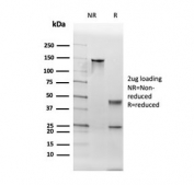 SDS-PAGE analysis of purified, BSA-free Thyroid Peroxidase antibody as confirmation of integrity and purity.