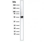 Western blot testing of His-tagged protein with Histidine antibody.