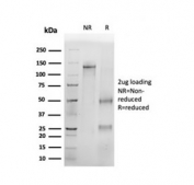 SDS-PAGE analysis of purified, BSA-free p16INK4a antibody (clone CDKN2A/4499) as confirmation of integrity and purity.