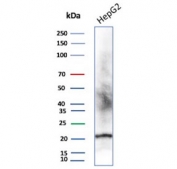 Western blot testing of human HepG2 cell lysate with recombinant p21 antibody (clone CIP1/4377R).