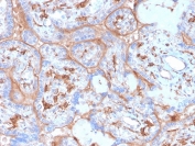 IHC staining of FFPE human placenta with recombinant PDL1 antibody (clone rPDL1/4773). HIER: boil tissue sections in pH 9 10mM Tris with 1mM EDTA for 20 min and allow to cool before testing.