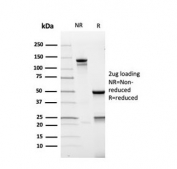 SDS-PAGE analysis of purified, BSA-free recombinant AMACR antibody (clone rAMACR/4674) as confirmation of integrity and purity.