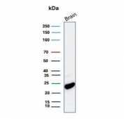 Western blot testing of human brain lysate with recombinant PGP9.5 antibody. Predicted molecular weight ~25 kDa.