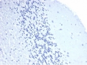 Negative control: IHC staining of FFPE human brain tissue with recombinant CD4 antibody. HIER: boil tissue sections in pH 9 10mM Tris with 1mM EDTA for 20 min and allow to cool before testing.