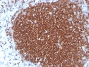 IHC staining of FFPE human lymph node with recombinant CD19 antibody. HIER: boil tissue sections in pH 9 10mM Tris with 1mM EDTA for 20 min and allow to cool before testing.
